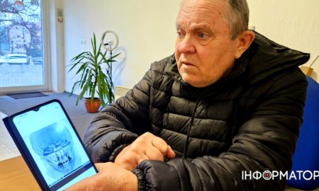 У Коломиї афганця побив сусід за ініціативу ремонту доріг на вулиці